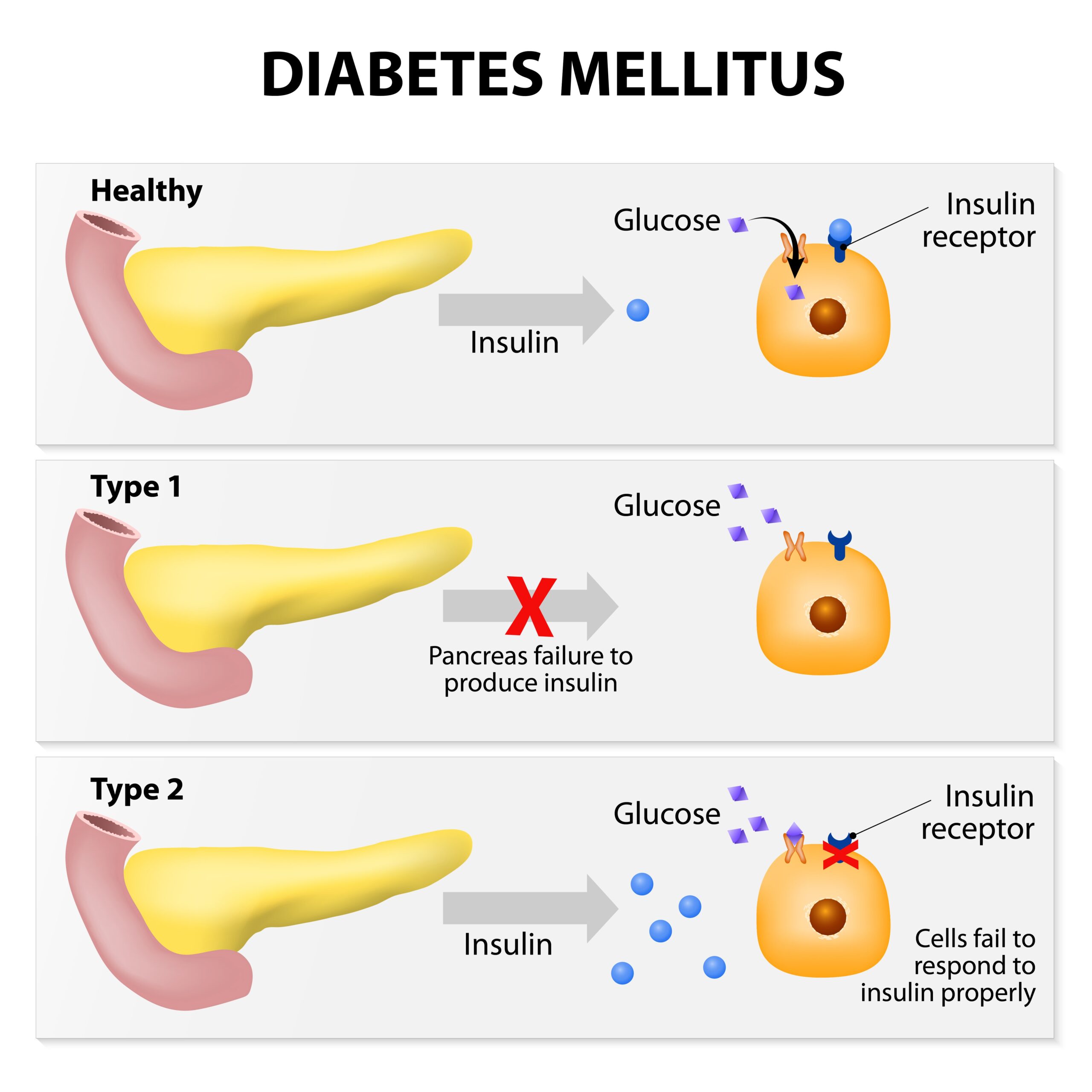 Diabetes Types | Fighting Arts Health Lab